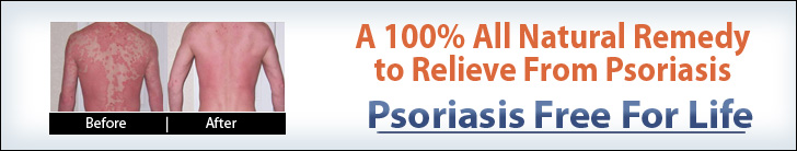 psoriasis free for life